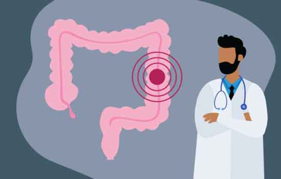 Colorectal Cancer