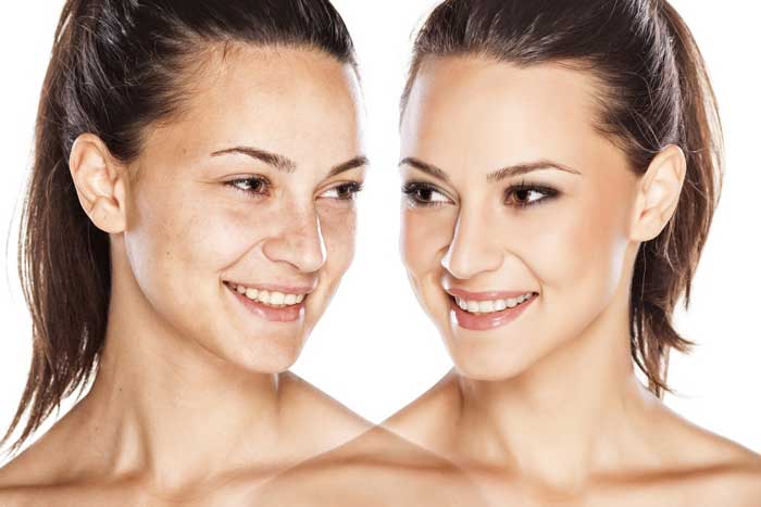 how to lighten skin overnight